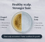 RE:ROOT – Pre-Shampoo Therapy