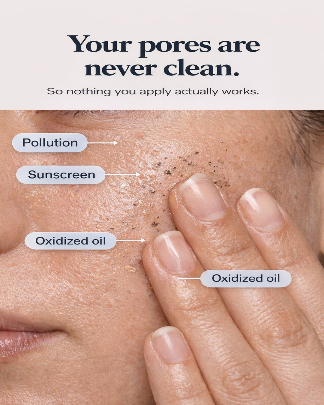 Complete Skin Hygiene System (3-step skin reset)